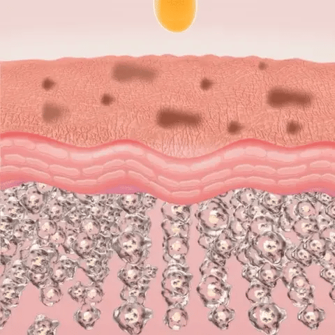 BOTOX STOCK SOLUTION | Suero Antiarrugas